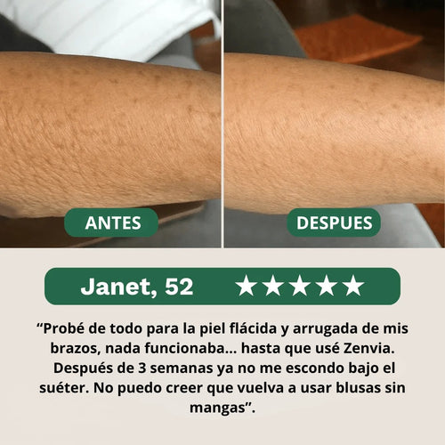 Crepey Skin — Loción Reparadora y Reafirmante